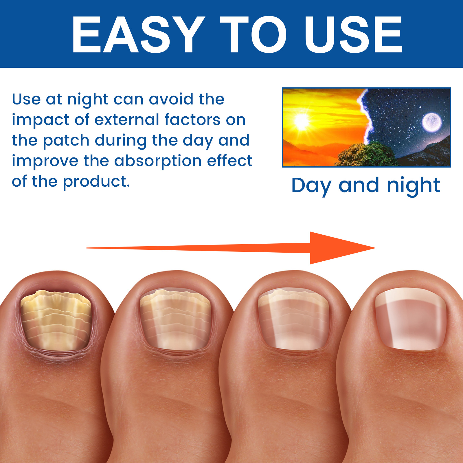 Alvantor Fungal Nail Patches, Overnight Repair for Damaged Thick Toenails, 8-Hour Treatment, 32PCS