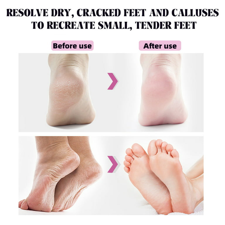Dropship Professional Electric Foot Grinder File Callus Dead Skin Remover  Pedicure Tool to Sell Online at a Lower Price