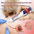 thumbnail image 2 of Nuevo 2023 contra la crema de verrugas genitales Vulva virus del papiloma humano topo eliminar rápidamente las verrugas de maíz del pie elimina los lunares etiqueta de la piel ungüentochangzhao, 2 of 3
