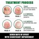 thumbnail image 3 of 7days Nail Treatment, Ginger Nail Treatment, Multi-purpose Nail Repair, Nail Nutrient Oil Strengthener Oil Serum Ginger Nail Growth Oil, 3 of 5