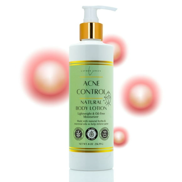 Acne Control Natural Body Lotion - Acne Relief, Oil-Free & Lightweight Moisturizer - 8 oz by LatherGreen
