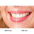 thumbnail image 5 of Dental blanco avanzado blanqueamiento de dientes pegatinas tiras de blanqueador de dientes herramienta de higiene bucal, 5 of 5