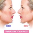 thumbnail image 2 of V-Face Band Ygjytge Adelgazamiento Facial TPU Banda Elástica Herramientas Vendaje, 2 of 8