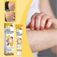 thumbnail image 3 of Vitiligo Bee-Venom Treatment Cream for Skin Pigmentation, Psoriasis Relief, Reduces White Spots, Portable Anti-itch Ointment for All Skin Types, 3 of 5