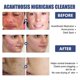 thumbnail image 2 of Black Acanthus Facial Cleanser Deep Cleansing, Softening, Skin Repair, Fading Facial Dullness, Whitening Facial Cleanser, Cosmetics And Facial C, 2 of 4