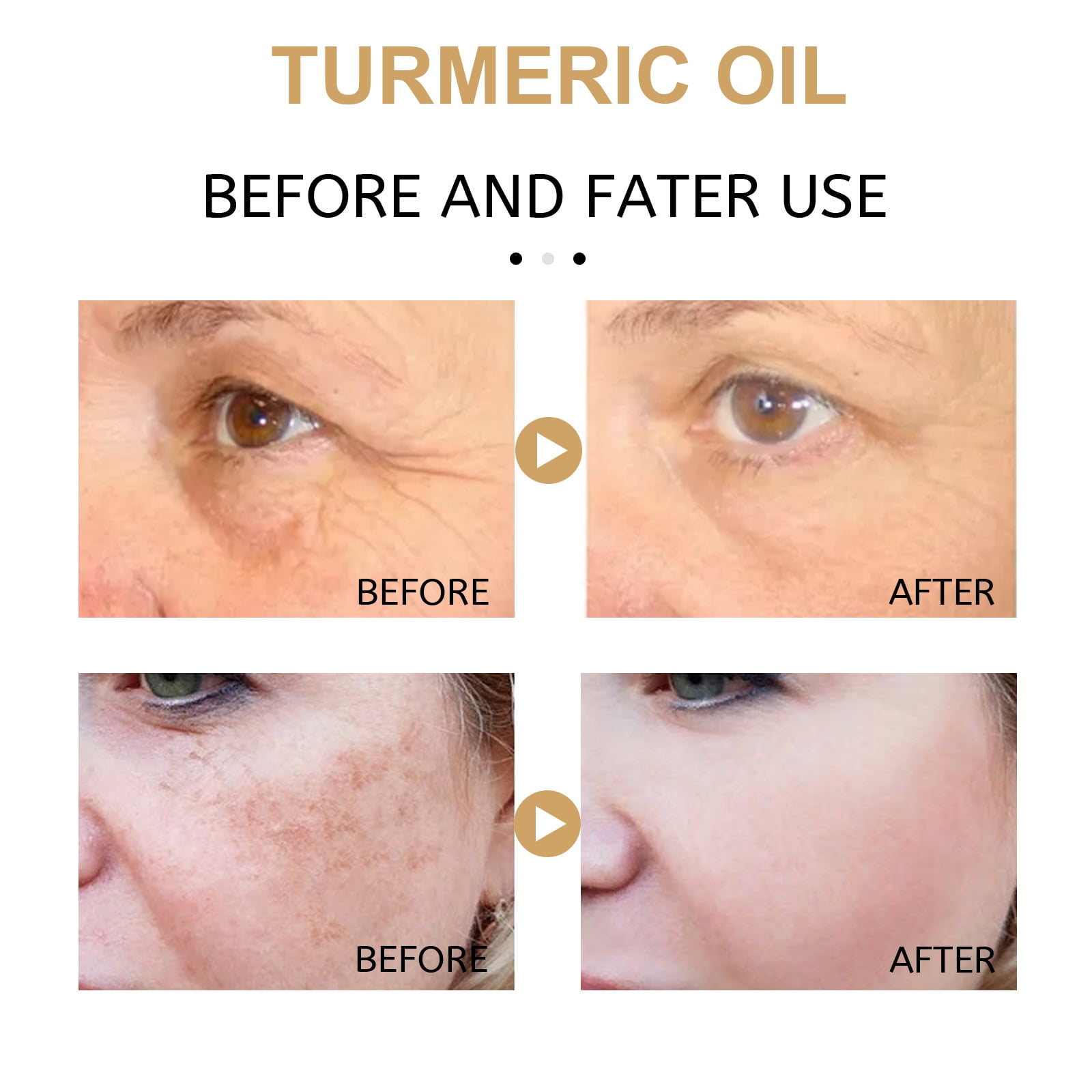 Alvantor Turmeric Facial Oil - Dark Spot Corrector & Hydration, 1.01 fl oz