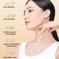 thumbnail image 5 of YiJuHui 1pcs V Line Lifting Mask, Adjustable Chin Strap for Sleeping, Jaw Exerciser Face Lift Prevent Sagging, Chin and Cheek Lifting Bandage for V Face Lift, 5 of 10