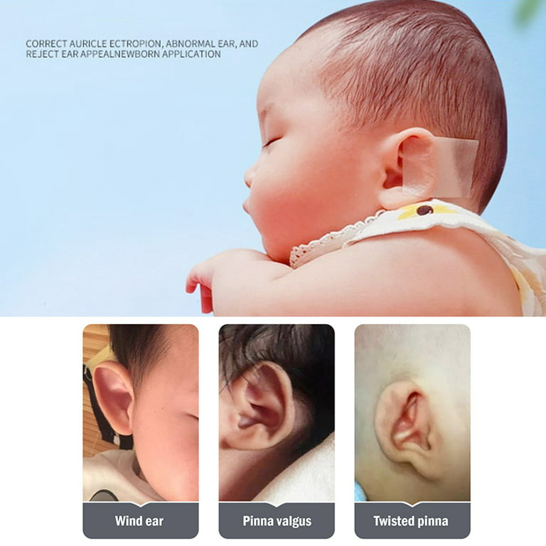 Baby Ear Correctors Medical Silicone Tape Infant Ear Correction Pa-ssSSWA
