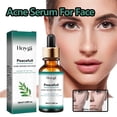 thumbnail image 4 of Sérum reductor de poros 30 ml para una piel más clara y poros minimizados, hidratación profunda y textura mejorada, desobstruye los poros disolviendo la grasa y las células muertas, mejora la tez y, 4 of 8