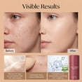 thumbnail image 3 of New Color Changing Foundation for Women, Long-Lasting Lightweight Makeup Liquid Foundation with SPF 15, Deep Hydration & Refines Pores, Medium to Full Coverage Cream for Mature Skin, 30ML, 3 of 7