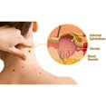 thumbnail image 4 of Personal Skin Care New Lipogo For All Parts Of The Body (1 Pack), 4 of 9