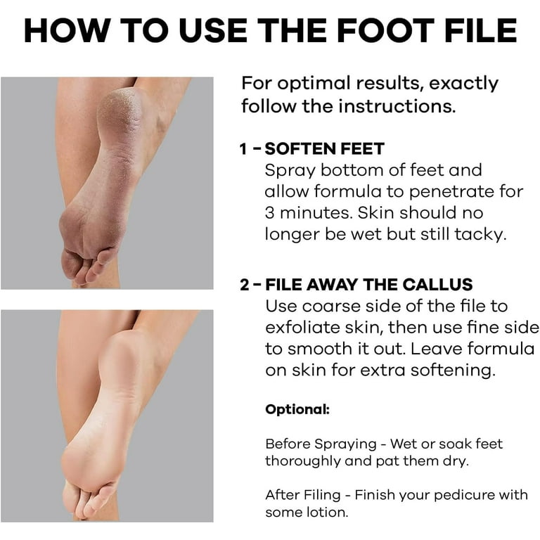 Callus Remover Foot Scrub Kit: Spray-on Formula & Foot File
