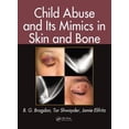 thumbnail image 1 of Pre-Owned Child Abuse and Its Mimics in Skin and Bone, (Hardcover), 1 of 1