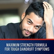 Selsun Blue Dandruff Shampoo Medicated 11 oz (Pack of 2)