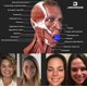 thumbnail image 4 of Entrenador de línea de mandíbula YONGSHENG tensor facial 3 uds, 4 of 5