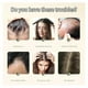 thumbnail image 3 of Ginger Plant Extract Anti-Hair Loss Hair Shampoo,Oil Control Hair Care Plant Shampoo ,Nourishing Sha, 3 of 5