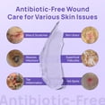 thumbnail image 6 of HICC PET Antimicrobial Pet Hydro Gel Wound Care for Dogs, 3.4-fl oz bottle, 6 of 7