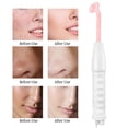 thumbnail image 4 of High Frequency Facial Machine Facial Machine For Skin Tightening Skin Care Facial Machine High Frequency Electrode Facial Machine For Skin Body Care Wrinkle Remover, 4 of 8