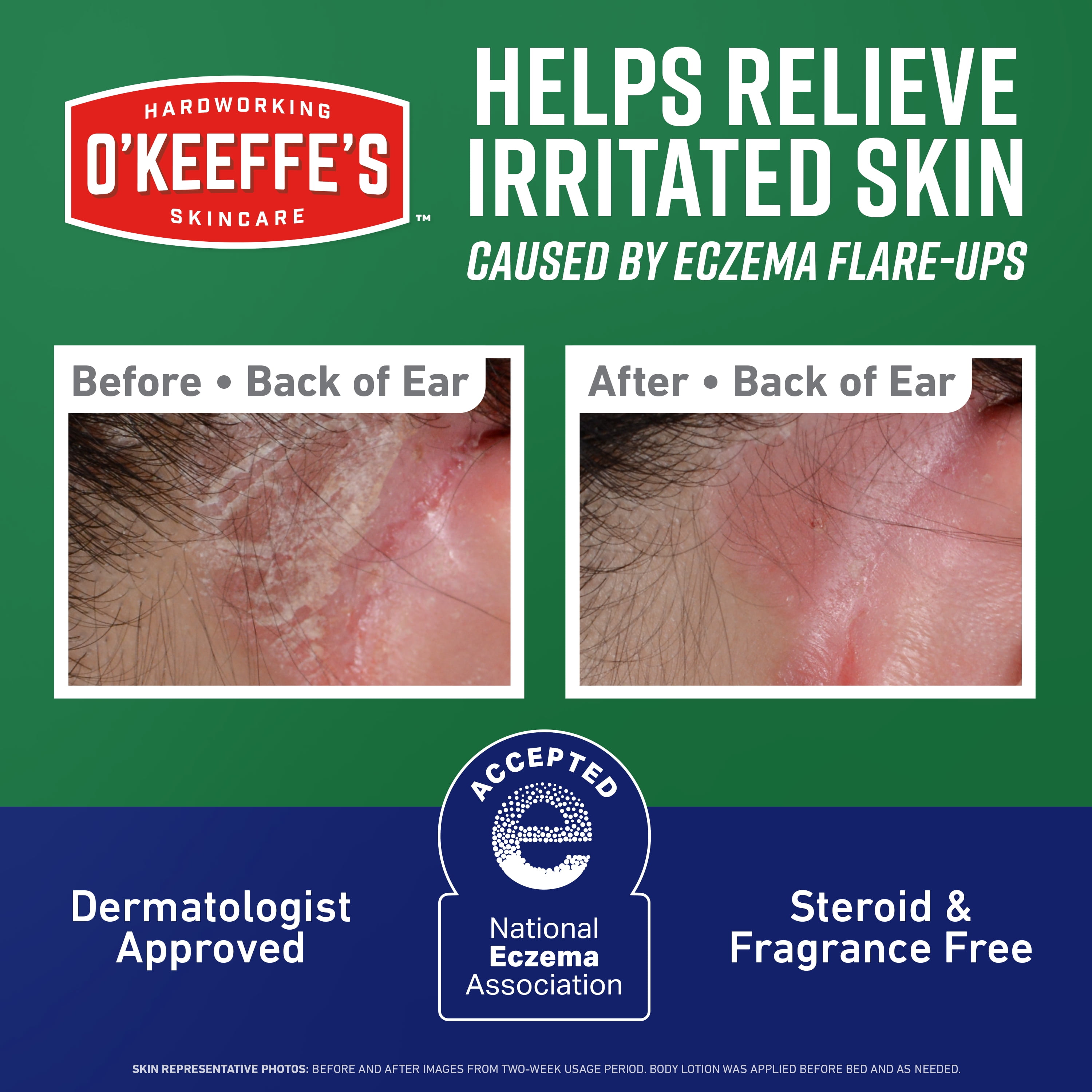 O’Keeffe’s Skin Repair Eczema Relief Body Cream, 48 Hour Moisture, 2% Colloidal Oatmeal, Unscented, 7oz Tube