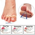 thumbnail image 3 of Gel Hammer Toe Crests Pads x 10 Pcs Silicone Toe Straightener Cushion Support Pain Relief for Hammer Toe, Overlapping Toes, Curled Toe-3 Loops, 3 of 5
