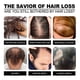 thumbnail image 2 of Jaysuing Garlic Shampoo Hair Cleaning Shampoo Moisturizing Head And Tail Hair Care - 100Ml, 2 of 5