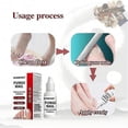 thumbnail image 4 of 15ml Fungi Nail Treatment Liquid Fast-Acting Nail Repair Strengthening Liquid Nails Care Supplies, 4 of 5