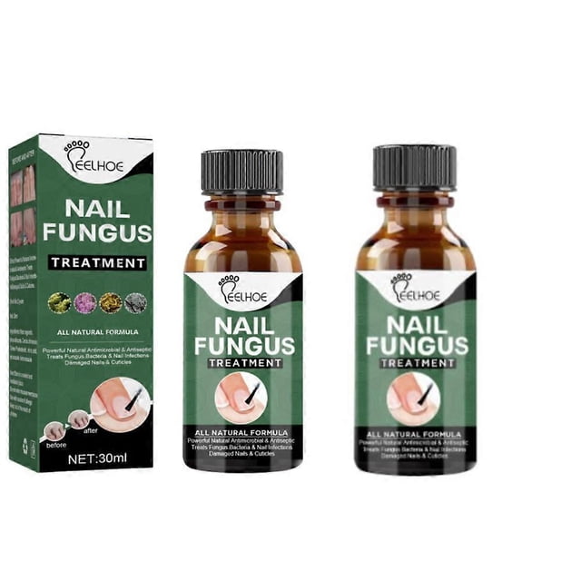 2pcs Extra Strength Nail Repair Fluid Toenail And Nail Solution Toenails And Nails Repair Damaged And Discolored Nails new