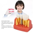 thumbnail image 4 of Modelo De Implante Dental, Modelo De Entrenamiento De Dientes De Implante, Demostración De Puente De Extraíble Para Profesionales Para Hospitales, 4 of 7