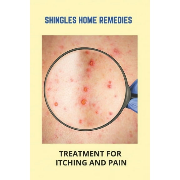 Shingles Home Remedies: Treatment For Itching And Pain: Shingles Recovery Stages, (Paperback)