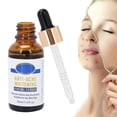 thumbnail image 4 of Anti-acne Facial Serum Moisturizing Serum Moisturizing AntiAcne Facial Serum Acne Treatment Skin Soothing Serum Solution 30ml ANGGREK Facial Serum, 4 of 8