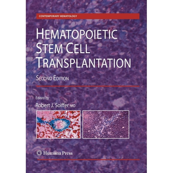 Contemporary Hematology Hematopoietic Stem Cell Transplantation, (Paperback)