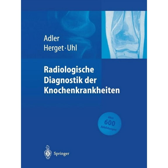 Radiologische Diagnostik Der Knochenkrankheiten, (Paperback)