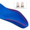 thumbnail image 4 of Kids Children Orthotics Insoles Correction Foot Care For Kid Flat Foot Arch Support Orthopedic Insole Soles Sport Shoes Pads EU36-39 25cm, 4 of 6