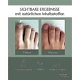thumbnail image 4 of 5x Healthroutine Nail Care Pen Cosmetic Nail Fungus Treatment Quick Intensive For Nails With Aloe Vera Tea Tree Oil_y95, 4 of 5