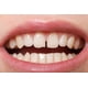 thumbnail image 2 of Reparación de encías con dientes sólidos Brackets caseros para dentaduras postizas Brackets de vampiro Brackets de tigre, 2 of 5