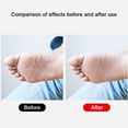 thumbnail image 6 of 2 Pcs Foot Files Callus Remover Generic Stainless Steel Foot Rasp Feet File Tools for Pedicure to Removes Hard Skin Corns for Dry and Wet Feet, 6 of 7