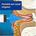 thumbnail image 4 of 2pcs Ear Cleaning Irrigation Kit Ear Wax Removal Tool Water Washing Syringe Comfortable Unique, 4 of 4
