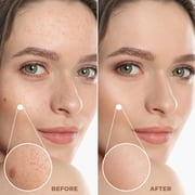 Profusion Cosmetics Lightweight Liquid Foundation for a Flawless and Elegant Radiance, Breathable Makeup that Improves Uneven Skin Tone, Vegan & Cruelty-Free, 30 mL, Medium 5