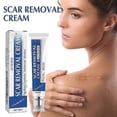thumbnail image 2 of Acnes Scars Removal Cream Effectiveness Non-irritating Cream For Face, 2 of 5
