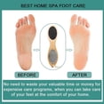 thumbnail image 5 of Foot File Callus Remover-multi Purpose 4 In 1 Feet Pedicure Kit With Foot Care Bristle Brush,pumice Stone,foot Rasp,sand Paper, 5 of 5