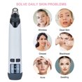 thumbnail image 3 of Blackhead Remover Kit Portable Charging Electric Pore Cleaner Blackhead Cleaner, 3 of 9