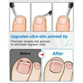 thumbnail image 3 of Nail Clippers,Toenail Clipper for Ingrown or Thick Toe Nails,Fingernail Clipper for Men Women Seniors with Stainless Steel Straight Blade Soft Handle Nail Cutter Black, 3 of 5