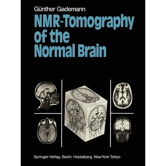 Nmr-Tomography of the Normal Brain, (Paperback)