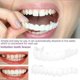 thumbnail image 3 of Fundas dentales postizas Smile Dental, carillas Perfect Smile, prótesis dentales Comfort Fit Flex., 3 of 5