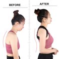 thumbnail image 2 of Back Orthopedic Straps Posture Corrector for Men and Women Fully Adjustable Spinal Brace Comfortable and Effective Upper Back Brace for Neck Shoulder Pain Relieve, 2 of 8