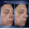 thumbnail image 4 of Sérum facial Lancôme Génifique Ultimate Dual Recovery 30 ml, 4 of 9