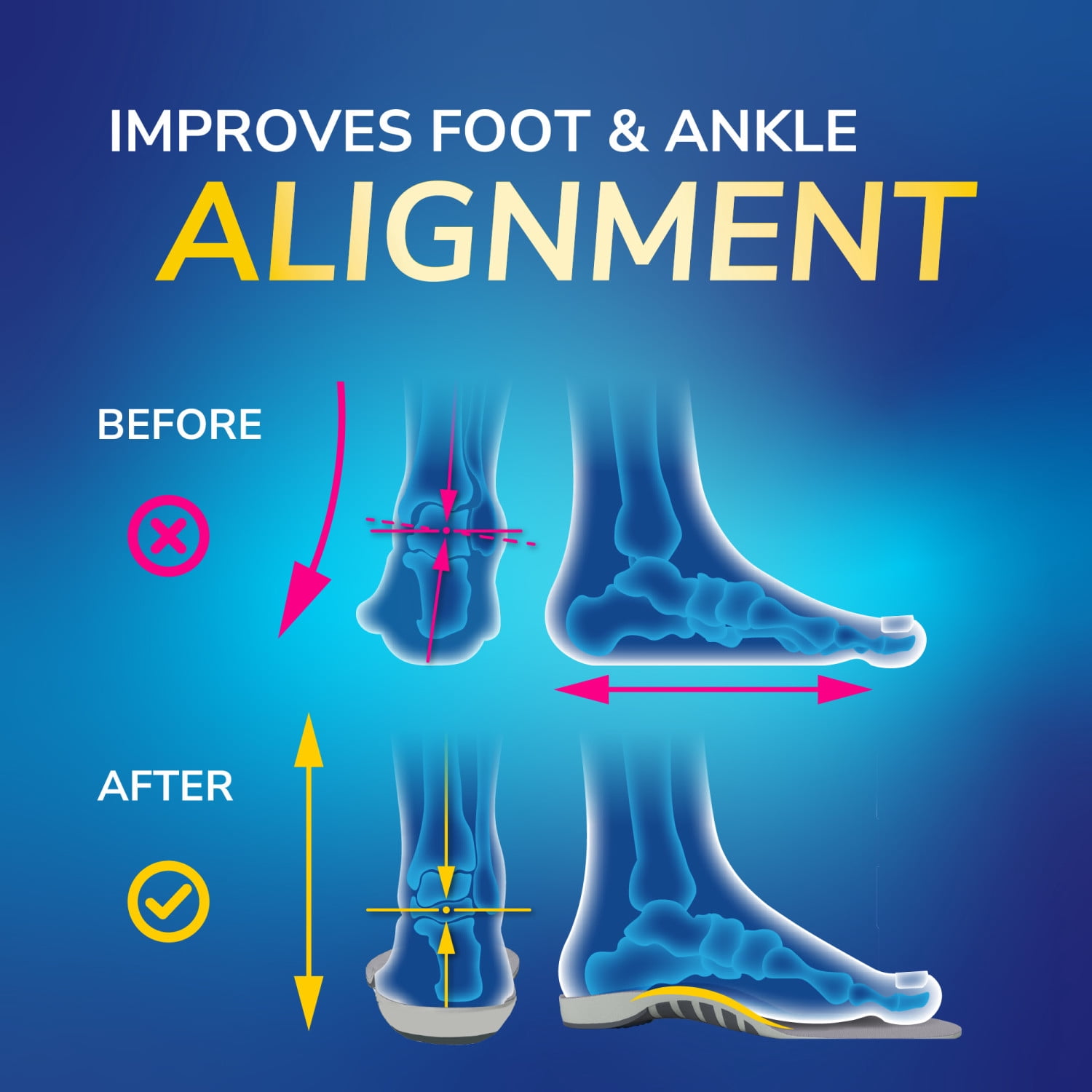 Dr. Scholl's Flat Feet Insoles for Men - 1 Pair