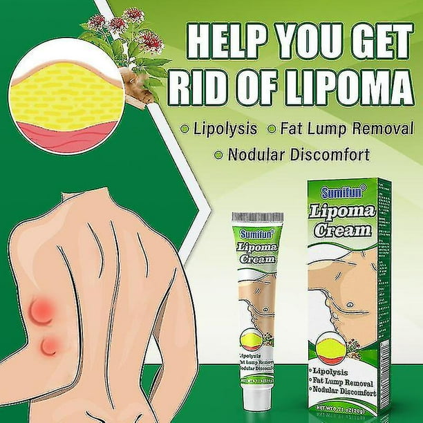 1Pcs 2 uds Sumifun 20g ungüento para lipoma crema para el tratamiento del lipoma crema para el cuidado del grano graso cuidado tópico de la piel hinchazón de la piel ungüento anticelulítico