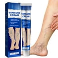 thumbnail image 3 of Crema para venas varicosas, 20g, crema de masaje de plantas naturales para eliminar varices y arañas vasculares, mejora la circulación sanguínea, 3 of 8