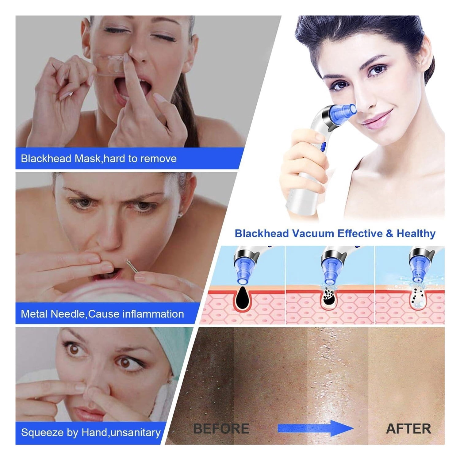 Blackhead Remover Pore Vacuum, Face Suction Pore Cleaner, 5 Suction Power Electric Blackhead Extractor Tool, 4 Probes, Blackhead Suction Remover for Women & Men